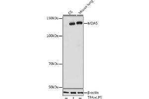 Western blot analysis of extracts of various cell lines, using MD antibody (ABIN7267950) at 1:1000 dilution. (IFIH1 抗体)