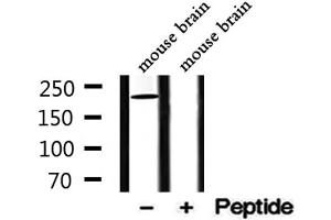 Western blot analysis of extracts from mouse brain, using DENND4A Antibody. (DENND4A 抗体  (Internal Region))