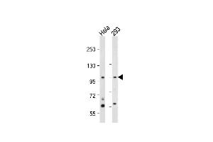 All lanes : Anti-hNEK4- at 1:2000 dilution Lane 1: Hela whole cell lysate Lane 2: 293 whole cell lysate Lysates/proteins at 20 μg per lane. (NEK4 抗体  (C-Term))
