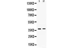 Western blot analysis of TNFRSF14/HVEM expression in HELA whole cell lysates ( Lane 1) and SW620 whole cell lysates ( Lane 2). (HVEM 抗体  (AA 39-202))