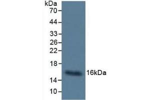 Detection of Cys-C in Human Urine using Monoclonal Antibody to Cystatin C (Cys-C) (CST3 抗体  (AA 27-146))