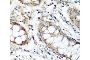 Immunohistochemistry of paraffin-embedded Human colon using NAA60 Polyclonal Antibody at dilution of 1:200 (40x lens). (NAT15 抗体)