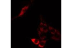 ABIN6275252 staining A549 cells by IF/ICC. (MPHOSPH9 抗体  (Internal Region))