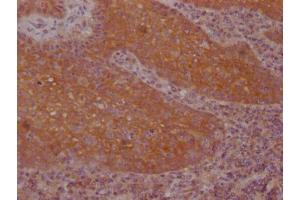IHC image of ABIN7127495 diluted at 1:100 and staining in paraffin-embedded human tonsil tissue performed on a Leica BondTM system. (Recombinant FNTB 抗体)