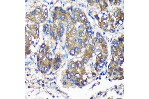 Immunohistochemistry (IHC) image for anti-SEC23 Interacting Protein (SEC23IP) (AA 600-940) antibody (ABIN7270170)