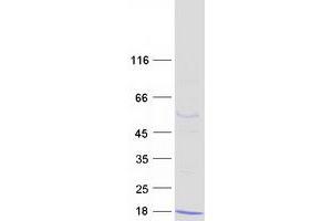 Western Blotting (WB) image for S100 Calcium Binding Protein A5 (S100A5) protein (Myc-DYKDDDDK Tag) (ABIN2731309)