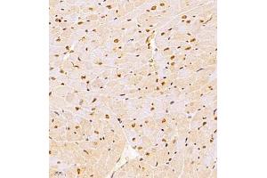 Immunohistochemistry of paraffin embedded rat heart using NSD3 (ABIN7076233) at dilution of 1:1400 (400x lens) (WHSC1L1 抗体)