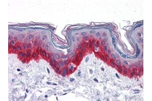 Immunohistochemistry (IHC) image for anti-Keratin 81 (KRT81) (AA 1-203) antibody (ABIN614629) (KRT81 抗体  (AA 1-203))