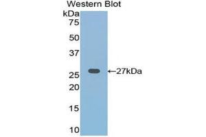 Western Blotting (WB) image for anti-Frizzled Family Receptor 1 (Fzd1) (AA 117-322) antibody (ABIN1858933) (FZD1 抗体  (AA 117-322))