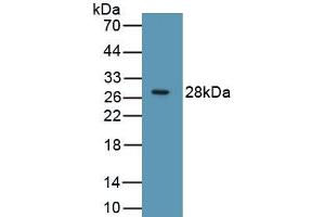 Detection of Recombinant RIPK3, Human using Polyclonal Antibody to Receptor Interacting Serine Threonine Kinase 3 (RIPK3) (RIPK3 抗体  (AA 1-217))