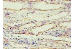 Immunohistochemistry (IHC) image for anti-Aldo-Keto Reductase Family 1, Member B1 (Aldose Reductase) (AKR1B1) (AA 1-316) antibody (ABIN7143685)