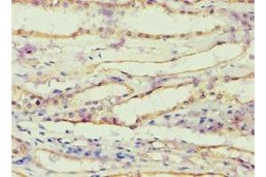 Immunohistochemistry of paraffin-embedded human kidney tissue using ABIN7143685 at dilution of 1:100 (AKR1B1 抗体  (AA 1-316))