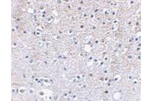 Immunohistochemical staining of human brain tissue using AP30386PU-N Grik5 antibody at 2. (GRIK5 抗体  (C-Term))