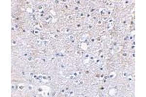 Immunohistochemical staining of human brain tissue using AP30386PU-N Grik5 antibody at 2.