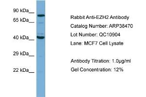 WB Suggested Anti-EZH2 Antibody Titration: 1. (EZH2 抗体  (N-Term))