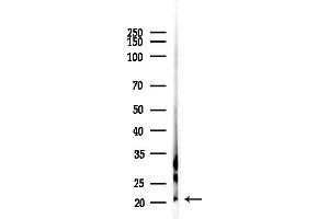 anti-Nucleoside-Triphosphatase, Cancer-Related (NTPCR) (C-Term) antibody