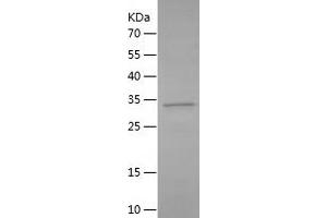 Western Blotting (WB) image for Complement Component (3d/Epstein Barr Virus) Receptor 2 (CR2) (AA 1-70) protein (His-IF2DI Tag) (ABIN7283408) (CD21 Protein (AA 1-70) (His-IF2DI Tag))