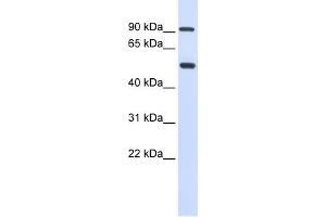 WB Suggested Anti-LOXL1 Antibody Titration: 0. (LOXL1 抗体  (Middle Region))