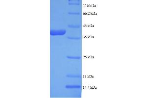 SDS-PAGE (SDS) image for Lactate Dehydrogenase B (LDHB) (AA 2-334) protein (His tag) (ABIN4974520)
