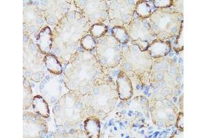 Immunohistochemistry of paraffin-embedded Mouse kidney using NEFH Polyclonal Antibody at dilution of 1:100 (40x lens). (NEFH 抗体)