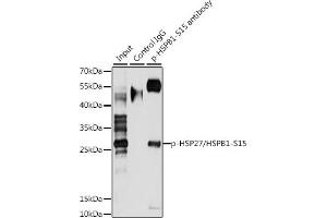 Immunoprecipitation analysis of 200 μg extracts of HeLa cells, using 3 μg Phospho-HSP27/HSPB1-S15 pAb . (HSP27 抗体  (pSer15))