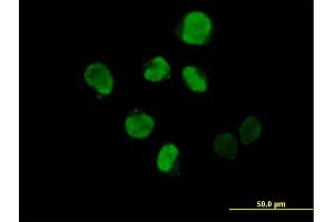 Immunofluorescence of purified MaxPab antibody to IHPK2 on HeLa cell. (IP6K2 抗体  (AA 1-426))