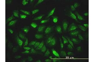 Immunofluorescence of monoclonal antibody to NCOA4 on HeLa cell. (NCOA4 抗体  (AA 1-575))