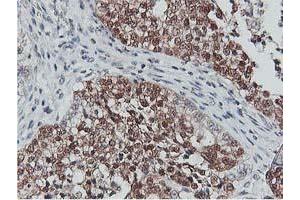 Image no. 5 for anti-CoA Synthase (COASY) antibody (ABIN1497556) (COASY 抗体)