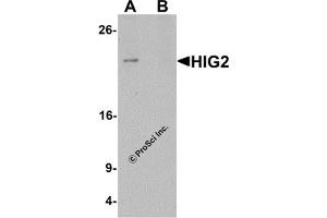 Western Blotting (WB) image for anti-Hypoxia Inducible Lipid Droplet-Associated (HILPDA) (C-Term) antibody (ABIN1030425)