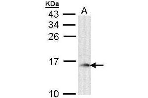 WB Image Sample (30 ug of whole cell lysate) A: Raji 15% SDS PAGE antibody diluted at 1:1000 (GMFB 抗体)