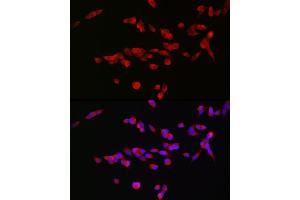 Immunofluorescence analysis of SH-SY5Y cells using GRIN2B Rabbit pAb (ABIN3017275, ABIN3017276, ABIN3017277 and ABIN1680110) at dilution of 1:100 (40x lens). (GRIN2B 抗体  (C-Term))