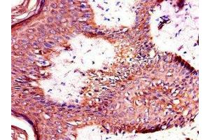 Immunohistochemistry of paraffin-embedded human skin tissue using ABIN7172328 at dilution of 1:100 (TANK 抗体  (AA 4-98))