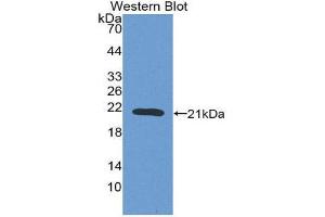 Western Blotting (WB) image for anti-Coagulation Factor II (thrombin) (F2) (AA 44-198) antibody (ABIN1077941)