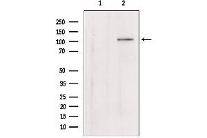 Western blot analysis of extracts from mouse lung, using Klotho Antibody. (Klotho 抗体)