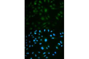 Immunofluorescence analysis of MCF7 cell using IL23R antibody. (IL23R 抗体  (AA 405-629))
