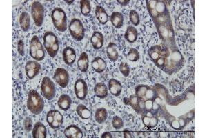 Immunoperoxidase of monoclonal antibody to ZNF259 on formalin-fixed paraffin-embedded human small Intestine. (ZNF259 抗体  (AA 361-459))