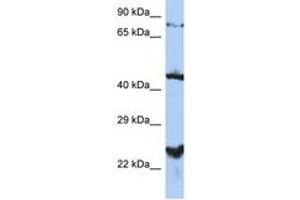 Image no. 1 for anti-MRS2 Magnesium Homeostasis Factor Homolog (MRS2) (AA 215-264) antibody (ABIN6743527) (MRS2 抗体  (AA 215-264))