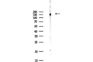 anti-DEP Domain Containing 2 (DEPDC2) antibody