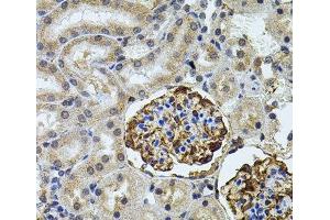 Immunohistochemistry of paraffin-embedded Rat kidney using CETP Polyclonal Antibody (CETP 抗体)