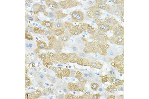 Immunohistochemistry of paraffin-embedded human liver using VEGFB Rabbit pAb (ABIN7271298) at dilution of 1:150 (40x lens). (VEGFB 抗体  (AA 25-207))