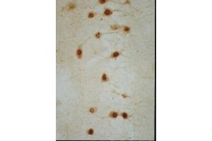 Frozen mouse hippocampus tissue labeled with Anti-Nurr1 Polyclonal Antibody, Unconjugated (ABIN725915) followed by conjugation to the secondary antibody
