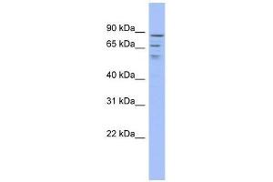 C1orf25 antibody used at 0. (TRMT1L 抗体  (Middle Region))
