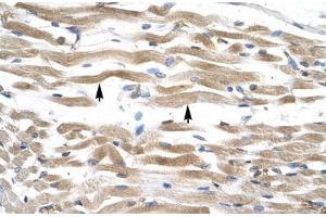 Immunohistochemical staining (Formalin-fixed paraffin-embedded sections) of human muscle with KIFC2 polyclonal antibody . (KIFC2 抗体  (AA 150-199))