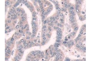 Immunohistochemistry (IHC) image for anti-Thiopurine S-Methyltransferase (TPMT) (AA 26-227) antibody (ABIN7435148)