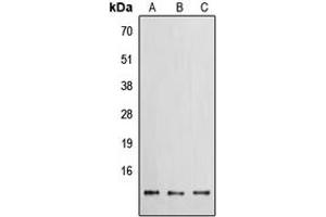Western blot analysis of EG-VEGF expression in HEK293T (A), Raw264. (Prokineticin 1 抗体  (Center))