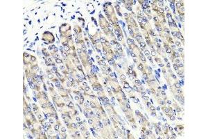 Immunohistochemistry of paraffin-embedded Mouse stomach using MAPKBP1 Polyclonal Antibody at dilution of 1:100 (40x lens). (MAPKBP1 抗体)