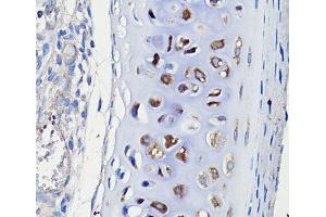 Immunohistochemistry of paraffin-embedded Rat trachea using COMP Polyclonal Antibody at dilution of 1:100 (40x lens). (COMP 抗体)
