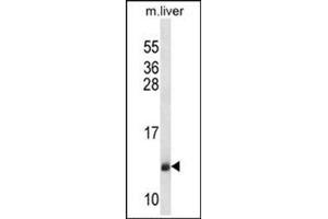 Western blot analysis of SEC61B Antibody (Center) Cat. (SEC61B 抗体  (Middle Region))
