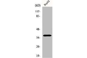 Western Blot analysis of Jurkat cells using Ephrin-A3 Polyclonal Antibody (Ephrin A3 抗体  (C-Term))