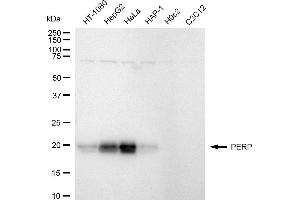 Western blotting analysis using PERP antibody (ABIN7800577). (Recombinant PERP 抗体)